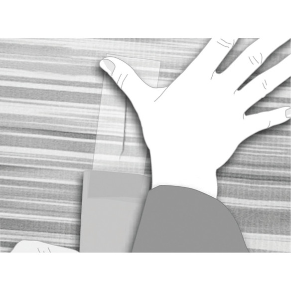 Kit de réparation pour stores Thule RG-483875